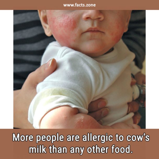 allergic to cow’s milk